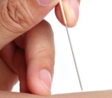 sports physiotherapist perth